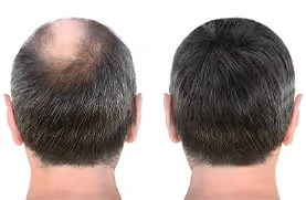 CelluHair Spray Results