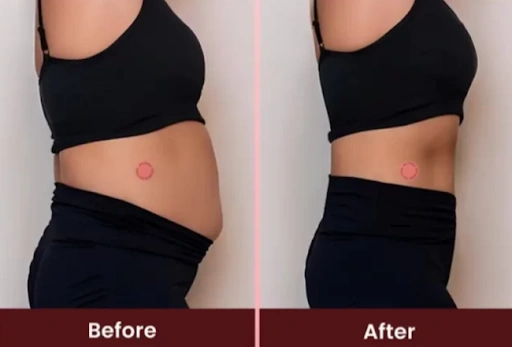 LeviaPatch GLP-1 Patch Before & After